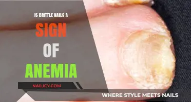 Brittle Nails and Anemia: Uncovering the Hidden Health Connection
