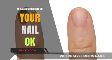 Calcium Deposits on Nails: Harmless or Health Concern?