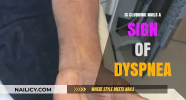 Clubbing Nails and Dyspnea: Unraveling the Connection and Symptoms