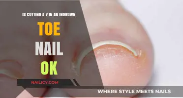 Toe Nail Relief: V-Cut Method Explained