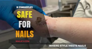 Exploring the Safety of Cyanoacrylate for Nail Care: Facts and Myths