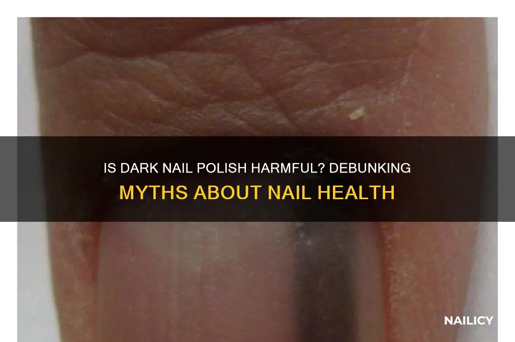 is dark nail polish bad for your nails