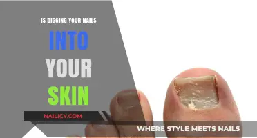 Is Digging Your Nails into Your Skin Harmful or Harmless?