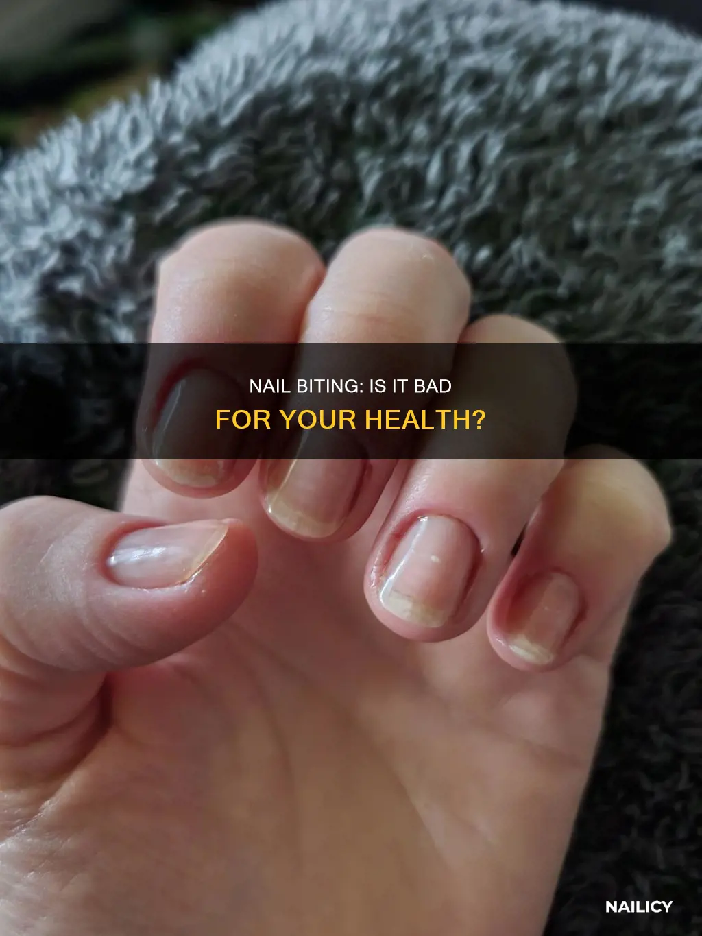 is eating your finger nails bad for you