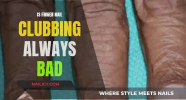 Fingernail Clubbing: What Does It Mean and Is It Dangerous?