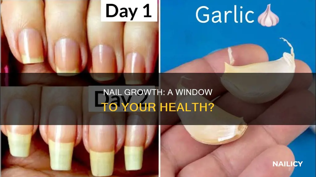 is finger nail fast growth mean good health