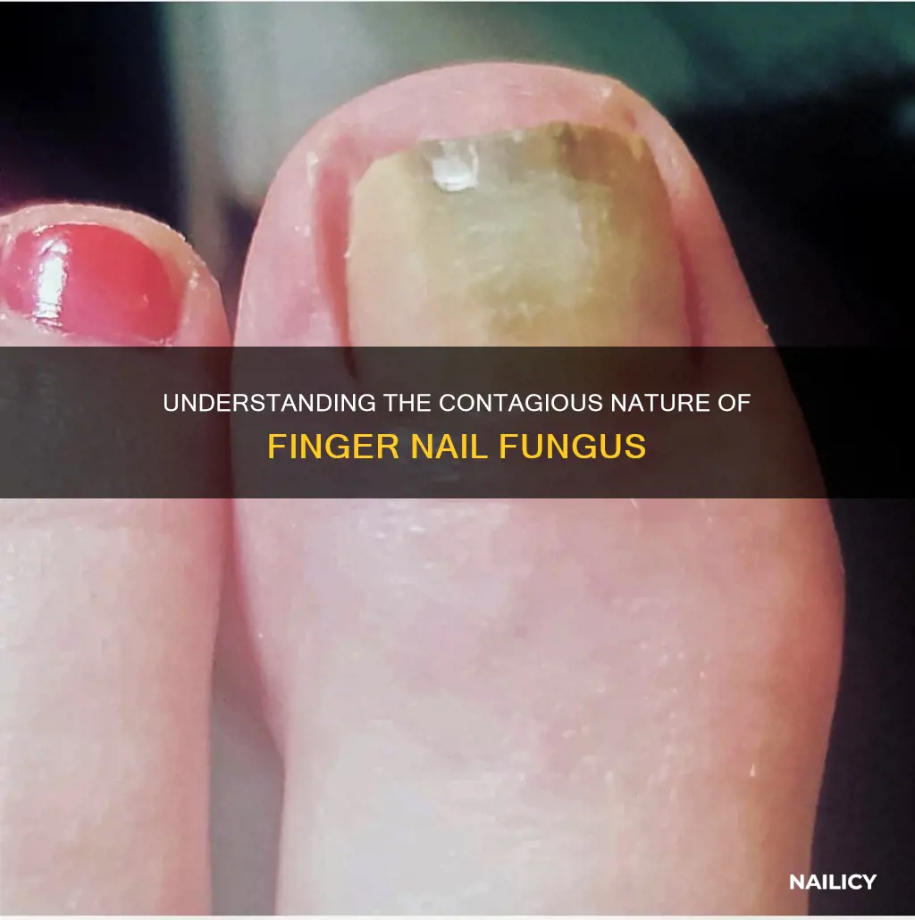 is finger nail fungus contagious