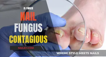 Fingernail Fungus: Is It Contagious and How to Prevent It?