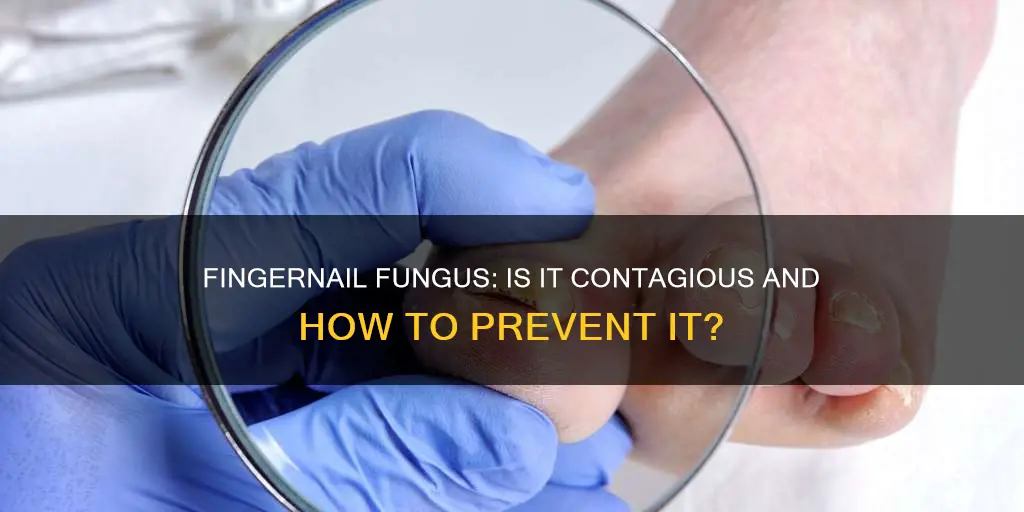 is finger nail fungus contagious