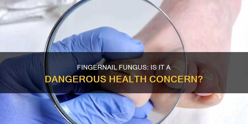 is finger nail fungus dangerous