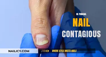 Is Fungal Nail Contagious: Facts, Myths, and Prevention Tips