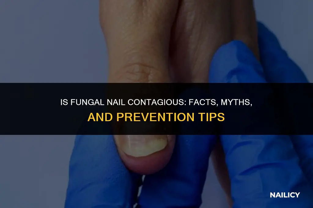 is fungal nail contagious