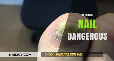 Unveiling the Truth: Is Fungal Nail Infection Really Dangerous?
