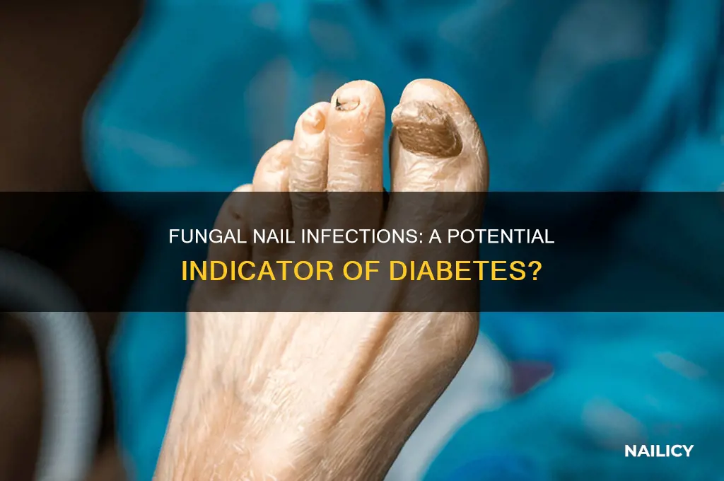 is fungal nail infection a sign of diabetes