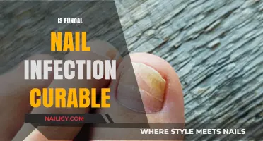Combatting Fungal Nail Infections: Effective Treatments and Prevention Tips