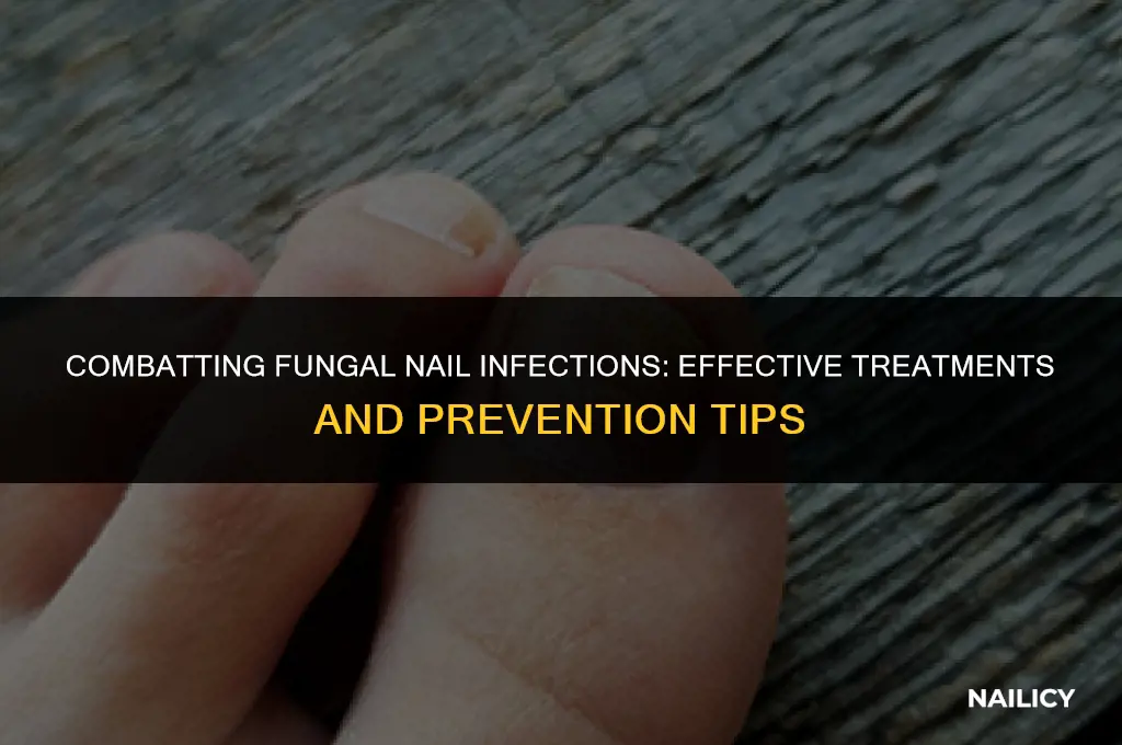 is fungal nail infection curable