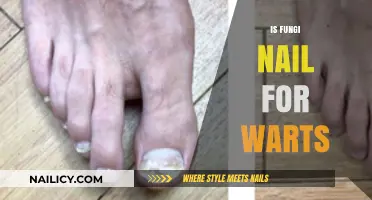 Exploring the Truth: Can Fungi Nail Treat Warts Effectively?