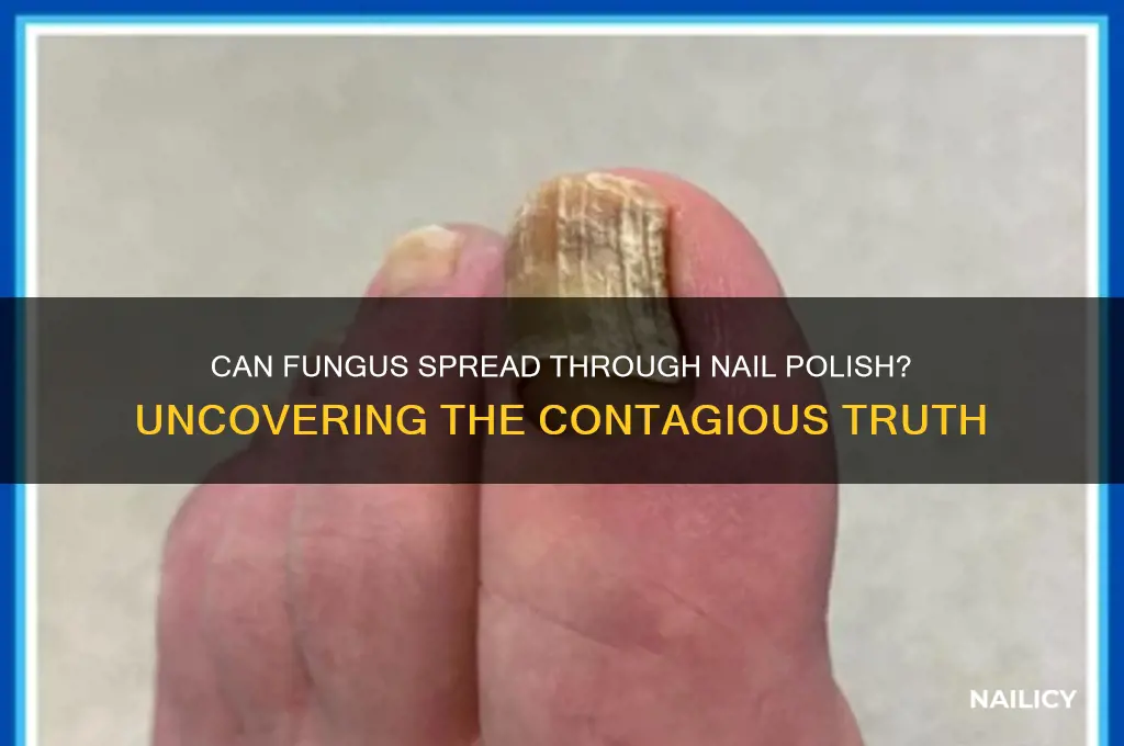 is fungus contagious through nail polish