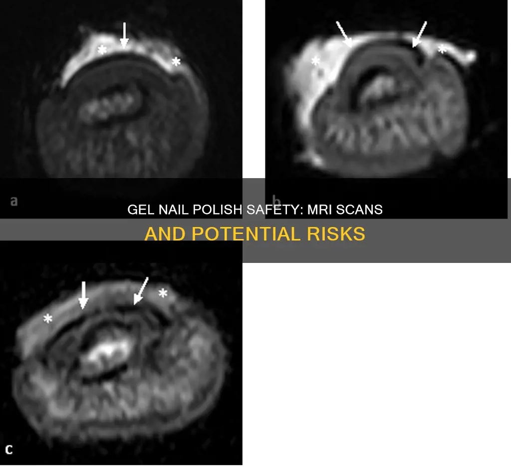 is gel nail polish safe for mri