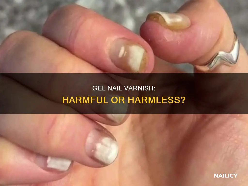 is gel nail varnish bad for your nails