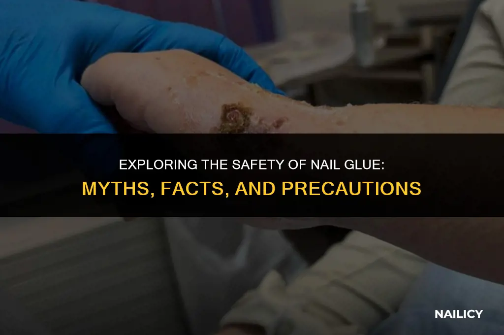 is gluing nails safe