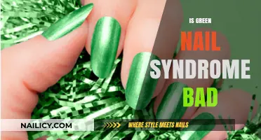 Unveiling the Truth: Is Green Nail Syndrome Harmful?