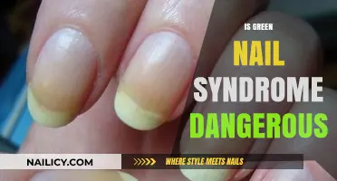 Is Green Nail Syndrome Dangerous? Understanding Risks and Treatment Options