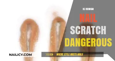 The Hidden Dangers of Human Nail Scratches: What You Need to Know