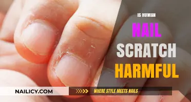 Are Human Nail Scratches Harmful? Uncovering the Risks and Facts