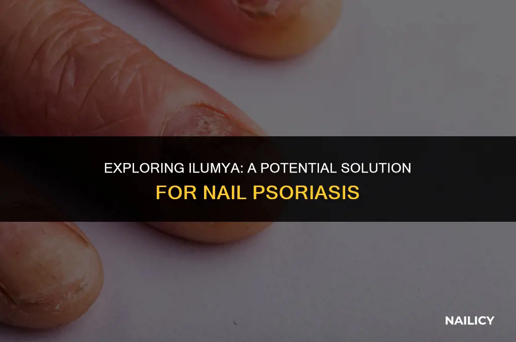 is ilumya for nails psoriasis