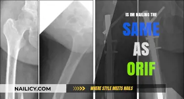 IM Nailing vs. ORIF: Understanding the Key Differences in Fracture Repair