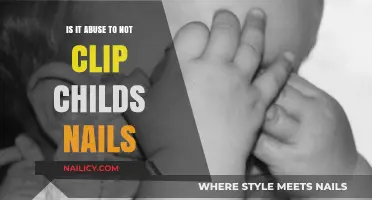 Neglecting Nail Care: Is It a Form of Child Abuse?