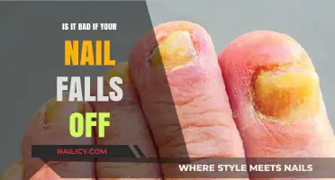 Nail Loss: Causes, Concerns, and When to Seek Medical Advice