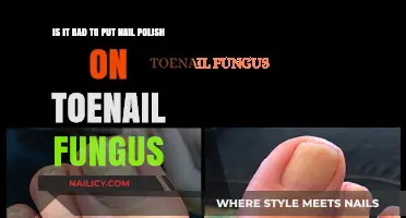 Toenail Fungus and Nail Polish: A Harmful Combination?