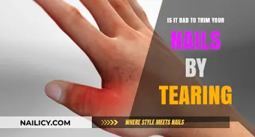 Tearing Nails: A Bad Trimming Habit?