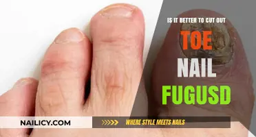 Toe Nail Fungus: Cut or Keep?