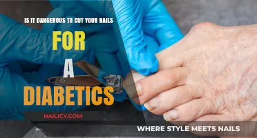 Diabetics and Nail Cutting: A Dangerous Mix?