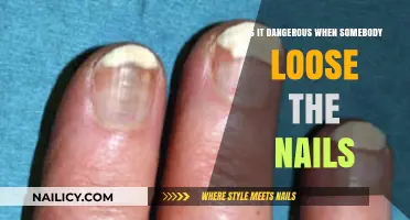 Losing Nails: Understanding the Risks and Potential Dangers Involved