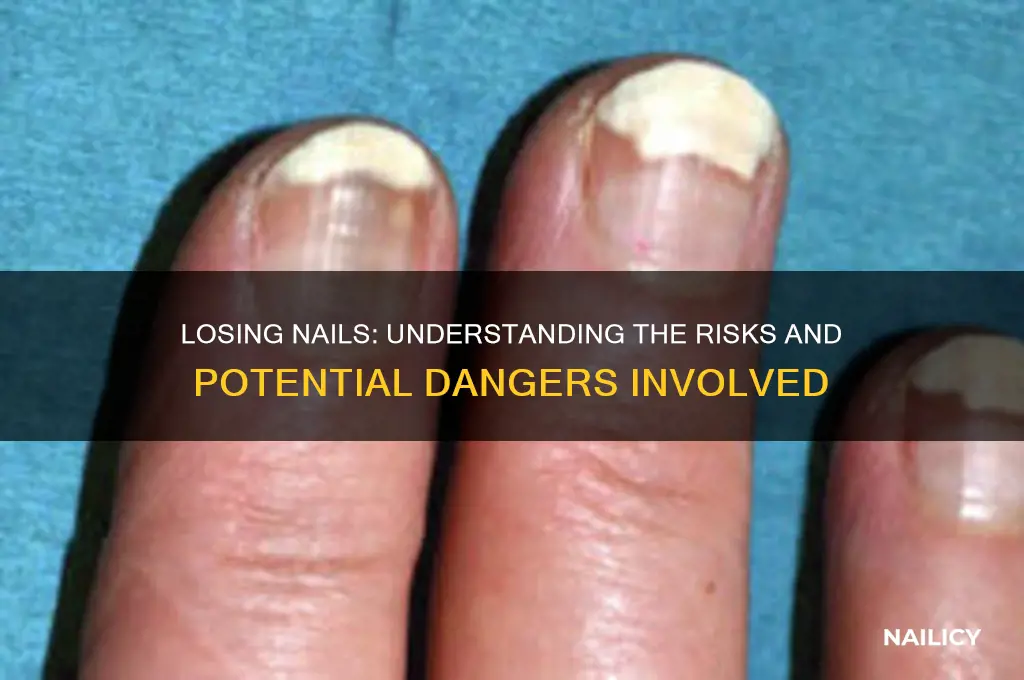 is it dangerous when somebody loose the nails