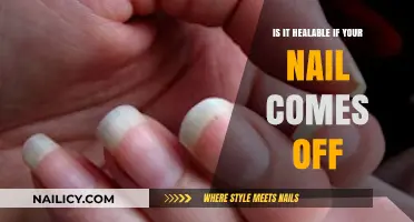 Nail Trauma: Can a Detached Nail Heal and Regrow Fully?