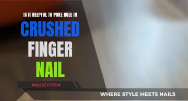 Poking Holes in Crushed Fingernails: Helpful or Harmful?