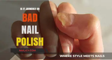 Jaundice or Nail Polish? How to Spot the Difference