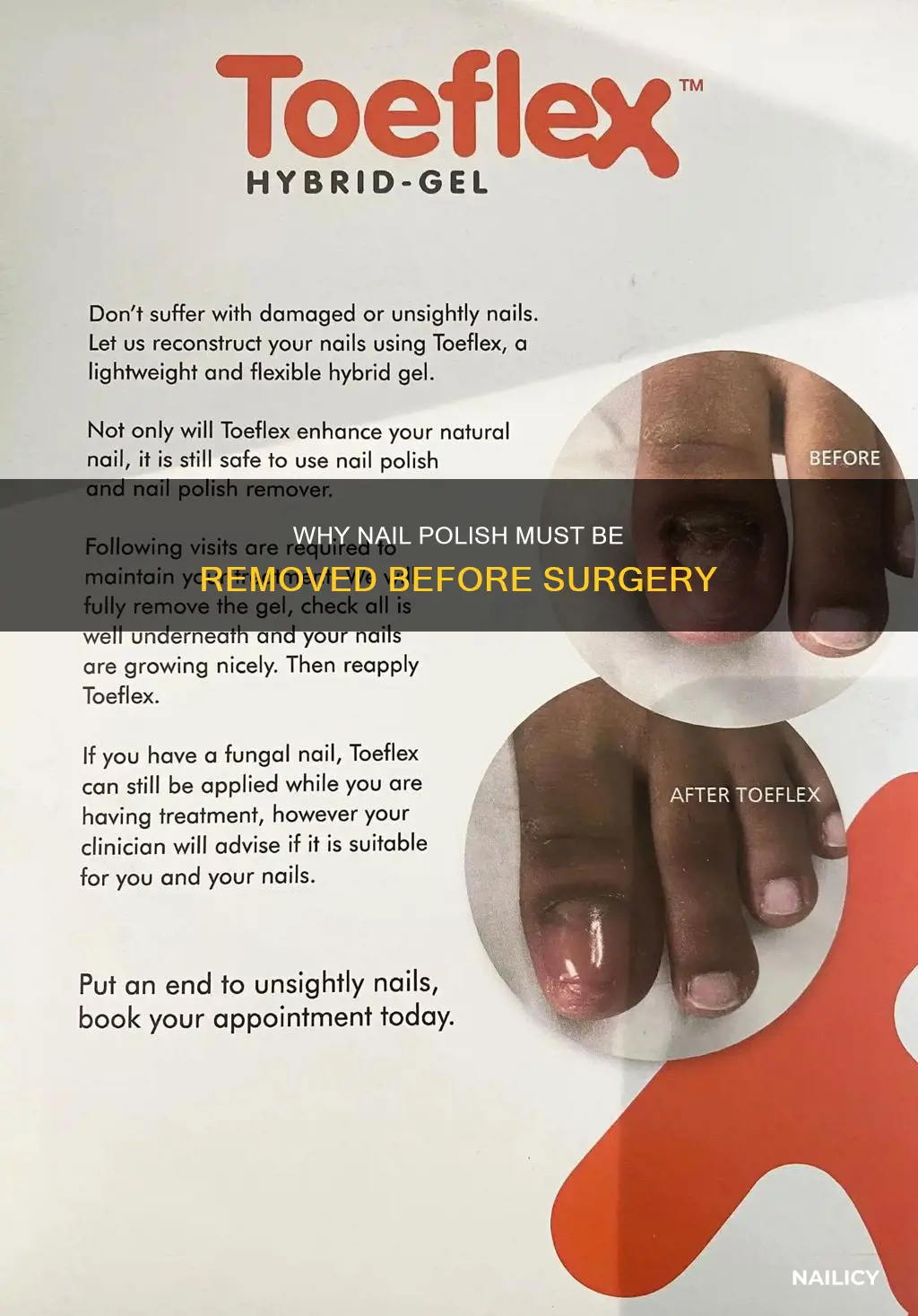 is it necessary to remove nail polish before surgery