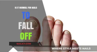 Is It Normal for Nails to Fall Off? Causes and Concerns