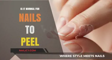Is Nail Peeling Normal? Causes, Concerns, and Solutions Explained