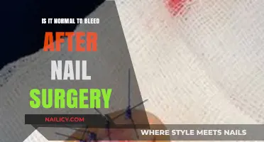 Post-Nail Surgery Bleeding: What’s Normal and When to Worry