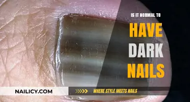 Dark Nails: Understanding Causes, Concerns, and When to Seek Help