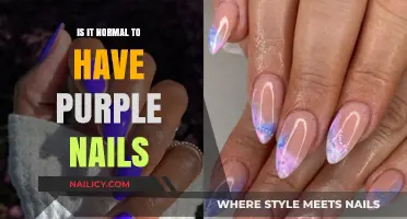 Purple Nails: Normal or Cause for Concern? Explained