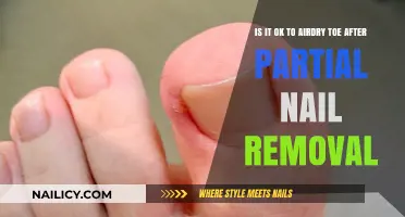Toe Care: Air Drying After Partial Nail Removal