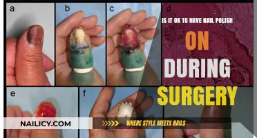 Nail Polish and Surgery: What You Need to Know Beforehand